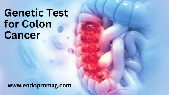 Genetic Test for Colon Cancer