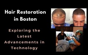 Hair-Restoration-in-Boston-Exploring-the-Latest-Advancements-in-Technology