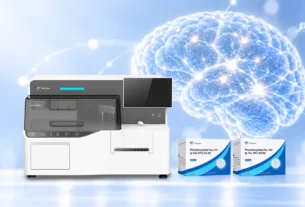 Alzheimer’s disease is a progressive neurodegenerative condition that affects memory, reasoning, language, and other cognitive abilities. As researchers work to understand its underlying biological mechanisms, biomarkers have become valuable tools for identifying disease-related changes, studying progression, and evaluating potential treatments. These measurable indicators can provide insights into processes that may begin years before noticeable symptoms develop. Recent advances in blood testing, cerebrospinal fluid analysis, and brain imaging have expanded the range of tools available to scientists. Understanding the most promising Biomarkers Of Ad can help researchers identify suitable analytical approaches, improve clinical study design, and investigate the biological changes associated with Alzheimer’s disease. 1. What Are Alzheimer’s Disease Biomarkers? Biomarkers are measurable biological characteristics that provide information about normal physiological processes, disease mechanisms, or responses to treatment. In Alzheimer’s research, they help scientists investigate the accumulation of abnormal proteins, neuronal injury, and changes in brain structure. Different biomarkers reflect different aspects of the disease. Some indicate amyloid pathology, others are associated with abnormal tau proteins, and additional markers provide information about neuronal damage or inflammation. Biomarkers can be measured using blood samples, cerebrospinal fluid (CSF), or imaging techniques. The most appropriate method depends on the research objective, the biomarker being investigated, and the required level of analytical accuracy. 2. Phosphorylated Tau: A Leading Biomarker Candidate Tau is a protein that supports the internal structure of neurons. In Alzheimer’s disease, abnormal changes in tau are associated with neurofibrillary tangles and neuronal dysfunction. Phosphorylated tau, commonly abbreviated as p-tau, has attracted considerable research attention because certain forms are closely associated with Alzheimer’s-related pathology. Important examples include p-tau181, p-tau217, and p-tau231. Why Is p-tau217 Particularly Promising? Blood-based p-tau217 has emerged as a particularly promising biomarker because studies have demonstrated its ability to reflect Alzheimer’s-related pathological changes. Depending on the assay and study population, it can help distinguish individuals with Alzheimer’s pathology from those with some other neurological conditions. Researchers are investigating p-tau217 for participant screening, disease characterization, and assessment of biological changes over time. Its potential use in blood samples may also reduce the need for more invasive testing in some research pathways. However, performance varies across assays and populations. Results must be interpreted alongside clinical information and other relevant findings rather than treated as a standalone determination of an individual's condition. 3. Amyloid-Beta Biomarkers Amyloid-beta is a protein fragment associated with the formation of amyloid plaques, one of the characteristic pathological features of Alzheimer’s disease. Researchers commonly measure amyloid-beta 42 (Aβ42) and amyloid-beta 40 (Aβ40). The Aβ42/Aβ40 ratio is particularly useful because it can provide more informative results than measuring Aβ42 alone in certain settings. Research Applications of Amyloid Biomarkers Amyloid biomarkers help researchers investigate the presence of amyloid pathology, characterize study participants, and evaluate treatments designed to affect amyloid accumulation. In cerebrospinal fluid, a reduced Aβ42 concentration or a lower Aβ42/Aβ40 ratio can be associated with amyloid deposition in the brain. Blood-based measurements are also being developed and evaluated for research and clinical applications. Although amyloid biomarkers provide important information, amyloid pathology does not fully explain every aspect of Alzheimer’s disease. Combining amyloid measurements with tau biomarkers and clinical assessments can provide a more comprehensive understanding. 4. Neurofilament Light Chain as a Marker of Neuronal Injury Neurofilament light chain (NfL) is a structural protein found in neuronal axons. When these axons are damaged, NfL can be released into cerebrospinal fluid and blood. Researchers study NfL as an indicator of neuroaxonal injury and disease progression. Its concentration may increase in several neurological conditions, including Alzheimer’s disease, making it useful for studying neuronal damage but less specific for identifying Alzheimer’s pathology on its own. Blood-based NfL testing is particularly attractive for longitudinal research because it may support repeated measurements without requiring repeated lumbar punctures. When used alongside amyloid and tau biomarkers, NfL can help researchers examine how Alzheimer’s-related pathology relates to neuronal injury over time. 5. Glial Fibrillary Acidic Protein and Neuroinflammation Glial fibrillary acidic protein (GFAP) is a protein associated with astrocytes, cells that support and maintain the brain's environment. Increased GFAP concentrations in blood or cerebrospinal fluid can reflect astrocyte activation and changes associated with neurological injury or disease. GFAP has gained interest as a potential marker of biological changes accompanying Alzheimer’s disease. It may provide information about astrocytic responses that complement measurements of amyloid, tau, and neuronal injury. However, GFAP is not specific to Alzheimer’s disease. It can also change in other neurological conditions, so researchers generally interpret it alongside additional biomarkers and clinical information. Its value lies in contributing another perspective on the biological processes occurring in the brain rather than independently establishing a diagnosis. 6. Blood-Based Biomarkers: A Major Area of Progress Blood-based biomarkers are among the most promising developments in Alzheimer’s research. Compared with cerebrospinal fluid collection, blood sampling is generally less invasive, more familiar to patients, and easier to incorporate into large studies. Current research includes plasma p-tau217, p-tau181, Aβ42/Aβ40, NfL, and GFAP. These biomarkers differ in their specificity, analytical performance, and intended applications. Key Advantages of Blood Testing Accessibility: Blood samples can be collected in many healthcare and research settings. Scalability: Blood-based methods can support large observational studies and clinical trials. Repeated measurement: Researchers can investigate biomarker changes at multiple time points. Research efficiency: Some blood tests may help identify participants who could benefit from confirmatory biomarker assessments. Despite these advantages, blood biomarker results can be influenced by factors such as age, kidney function, coexisting medical conditions, sample handling, and the analytical platform used. Validation is essential before applying a test to a particular research or clinical setting. 7. Cerebrospinal Fluid Biomarkers Remain Important Cerebrospinal fluid surrounds the brain and spinal cord and provides information about biological processes within the central nervous system. CSF biomarkers have an established role in Alzheimer’s research and remain important reference measures for evaluating newer approaches. Commonly investigated CSF biomarkers include Aβ42, the Aβ42/Aβ40 ratio, total tau, and phosphorylated tau. These measurements can help characterize amyloid and tau pathology and investigate relationships between molecular changes and clinical progression. Although lumbar puncture is more invasive than routine blood collection, CSF analysis offers a well-studied method for measuring disease-associated proteins. Researchers frequently compare blood-based biomarkers with CSF measurements and other reference methods to evaluate analytical performance and determine how different tests may complement one another. 8. Imaging Biomarkers for Detecting Brain Changes Imaging biomarkers provide information that complements biochemical measurements. They allow researchers to examine brain structure or visualize the distribution of particular pathological processes. Magnetic Resonance Imaging Magnetic resonance imaging (MRI) can reveal patterns of brain atrophy associated with neurodegeneration. Researchers may examine changes in regions involved in memory, including the hippocampus, and relate these findings to cognitive performance. Amyloid and Tau PET Imaging Positron emission tomography (PET) uses specialized tracers to help visualize amyloid plaques or tau aggregates in the brain. Amyloid PET can provide evidence of amyloid deposition, while tau PET can help characterize the distribution of tau pathology. Imaging can be valuable in research studies that investigate disease mechanisms or evaluate potential treatments. However, cost, availability, and technical requirements may limit its use compared with blood-based testing. 9. How Researchers Evaluate Promising Biomarkers A promising biomarker must demonstrate more than an association with Alzheimer’s disease. Researchers need to establish that it can be measured reliably and provides useful information for its intended application. Several criteria are particularly important. Analytical Performance Analytical sensitivity, specificity, precision, and reproducibility help determine whether an assay can measure a target accurately and consistently. Sample collection, processing, storage, and transportation can also affect results. Clinical Validity Clinical validity describes how well a biomarker relates to the biological or clinical condition it is intended to assess. Researchers may compare test results with established reference methods and evaluate performance in different populations. Clinical Utility A biomarker has clinical utility when its use meaningfully supports decision-making or improves a relevant outcome. In research, this may involve more efficient participant selection, improved characterization of disease biology, or better assessment of treatment effects. These criteria help distinguish an interesting research finding from a test that is sufficiently validated for a specific application. 10. The Role of Biomarkers in Clinical Trials Alzheimer’s biomarkers support several stages of clinical research, from identifying participants to evaluating investigational treatments. Researchers may use amyloid or tau biomarkers to determine whether participants meet the biological criteria for a study. This can be particularly important for trials targeting specific disease mechanisms. Biomarkers can also help assess whether a treatment affects its intended biological target. For example, a trial may monitor changes in amyloid-related measurements or phosphorylated tau after an intervention. However, a biomarker change does not automatically mean that a treatment improves memory, daily functioning, or long-term outcomes. Researchers must evaluate biomarker findings alongside clinical endpoints, safety data, and other relevant evidence. 11. Challenges and Future Directions Despite significant progress, Alzheimer’s biomarker research faces several challenges. Biomarker concentrations can vary with age, other health conditions, disease stage, and differences between analytical platforms. A test that performs well in one population may not produce identical results in another. Standardization is another important priority. Researchers need consistent sample-handling procedures, reliable quality-control methods, and validated assays to compare results across laboratories and studies. Future work will likely focus on combining multiple biomarkers to capture different aspects of Alzheimer’s biology. Integrating blood tests with imaging, cognitive assessments, and clinical information may improve research efficiency and support more individualized evaluation. Researchers are also investigating whether emerging biomarkers can help characterize disease progression earlier and identify biological changes associated with specific treatment responses. Conclusion The most promising biomarkers of Alzheimer’s disease include phosphorylated tau, amyloid-beta measurements, neurofilament light chain, GFAP, and imaging-based indicators of brain changes. Among these, blood-based p-tau217 has attracted particular attention for its potential to reflect Alzheimer’s-related pathology through a relatively accessible testing method. Each biomarker provides different information, and no single measurement captures every aspect of the disease. Combining complementary biomarkers with appropriate clinical assessments can help researchers develop a more complete understanding of Alzheimer’s biology. As assay technology, validation methods, and research standards continue to advance, biomarkers are expected to remain central to Alzheimer’s studies, clinical trial development, and investigations into more precise approaches to disease evaluation.